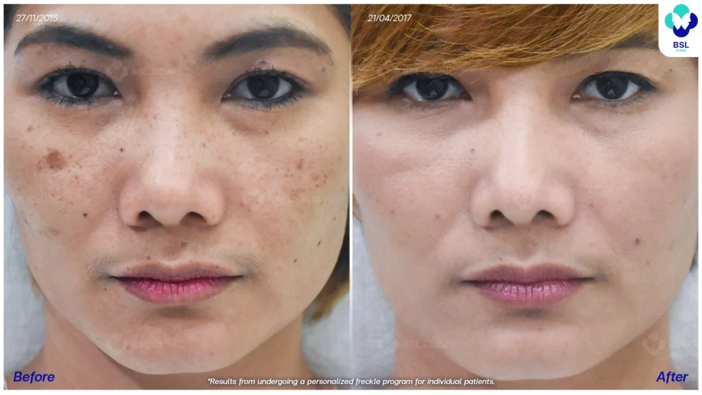 ตัวอย่างผลลัพธ์กระเฉพาะบุคคล