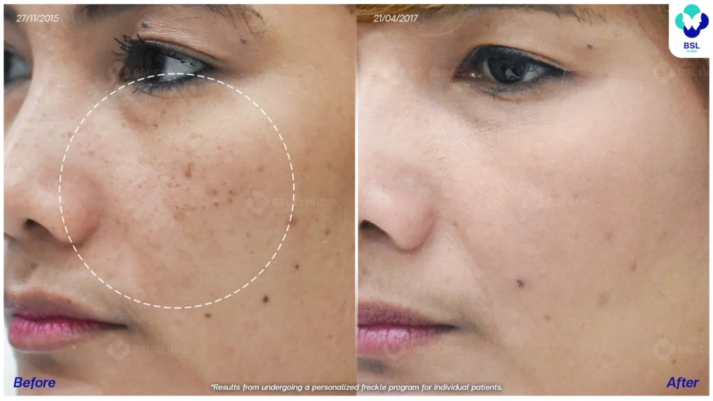 ตัวอย่างผลลัพธ์กระเฉพาะบุคคล