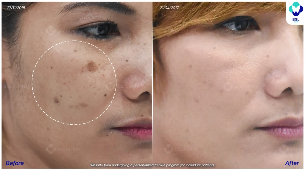 ตัวอย่างผลลัพธ์กระเฉพาะบุคคล