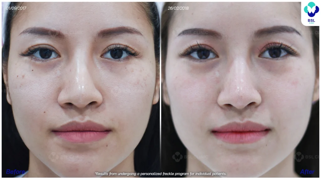 ภาพกระหลังรับการดูแล