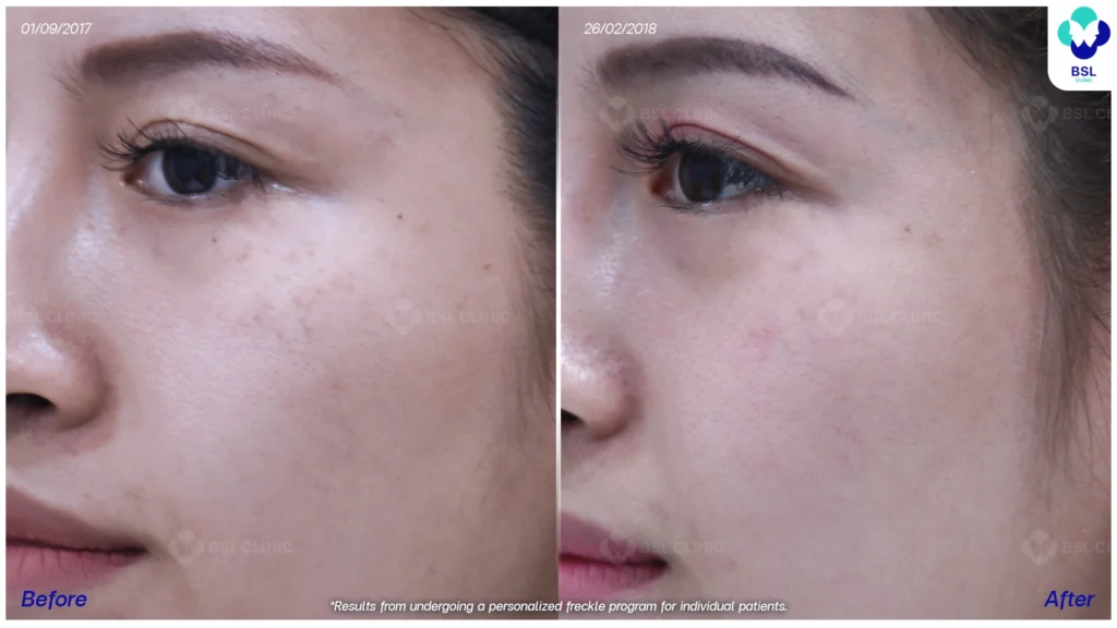 ภาพกระหลังรับการดูแล