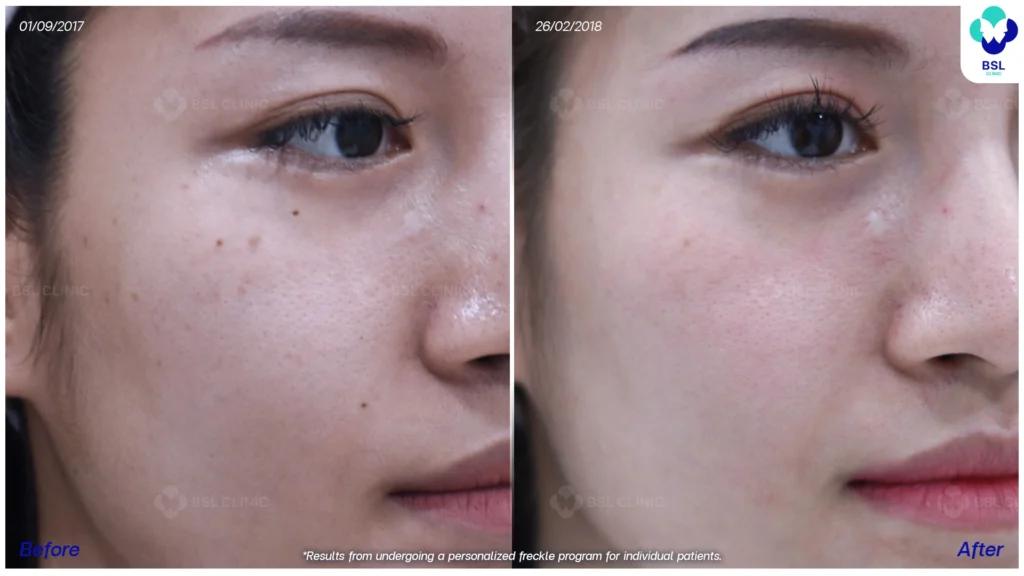 ภาพกระหลังรับการดูแล