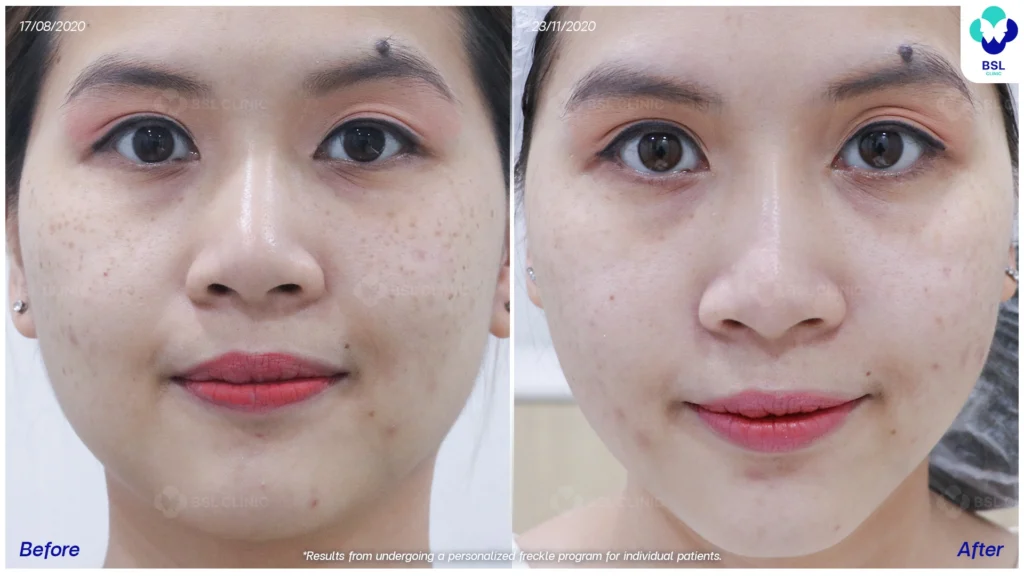 ภาพกระก่อนรับการดูแล