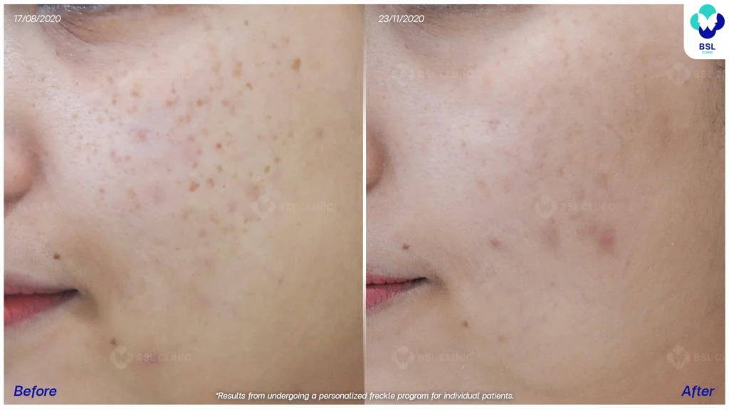 ภาพกระก่อนรับการดูแล