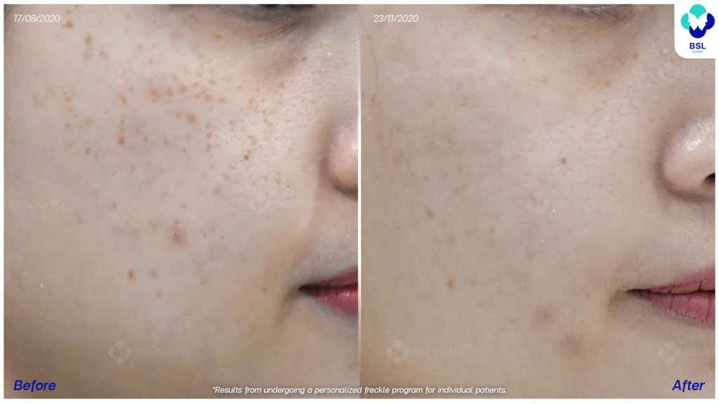 ภาพกระก่อนรับการดูแล