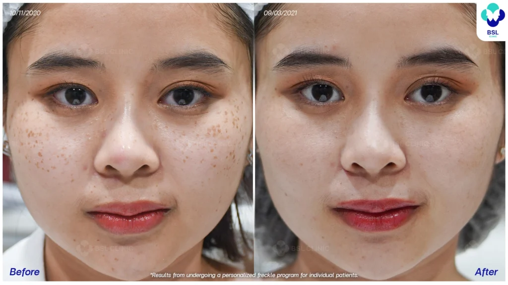 เคสกระในผู้รับบริการจริง