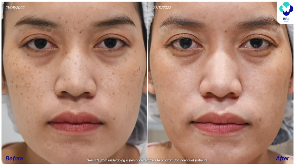 ดูแลปัญหากระกับ BSL Clinic