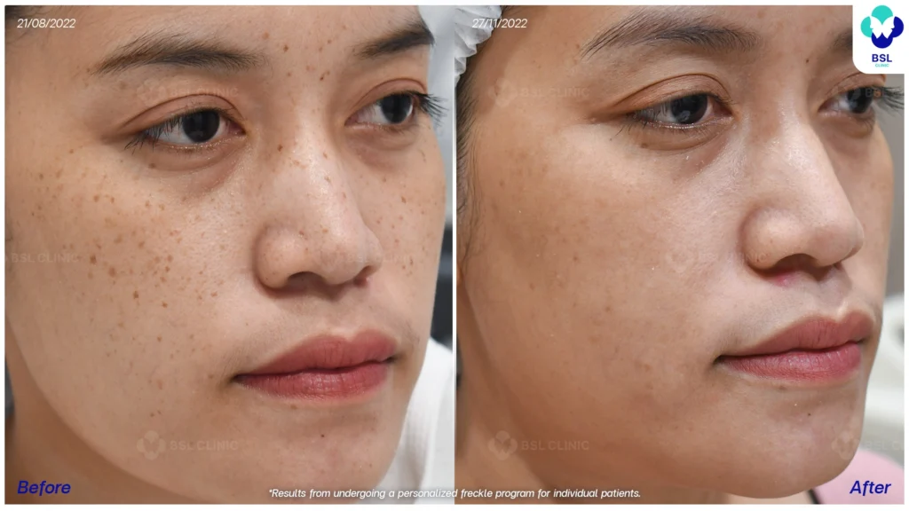 ดูแลปัญหากระกับ BSL Clinic