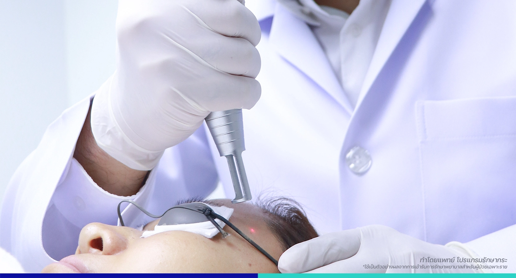 คลินิกเลเซอร์กระฝ้า