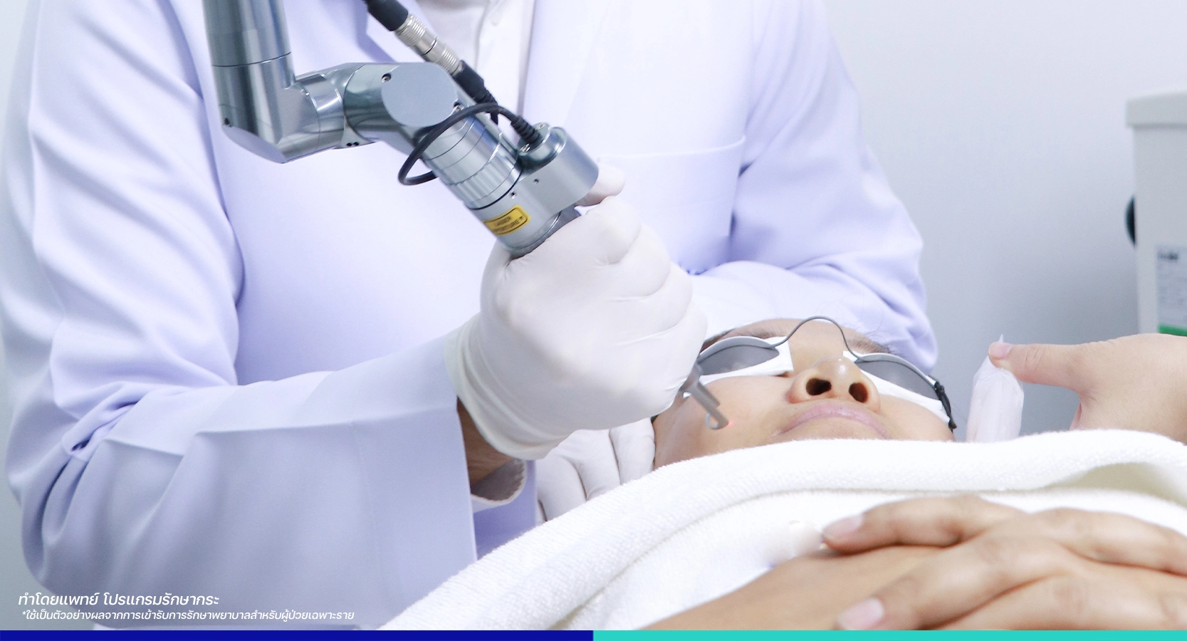 คลินิกเลเซอร์กระฝ้า