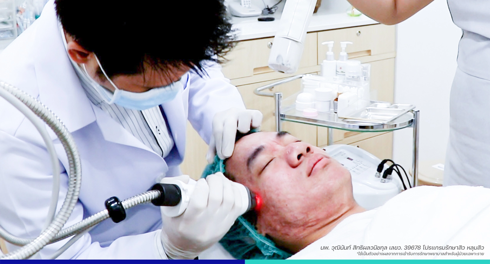 รักษาหลุมสิว รักษาสิว