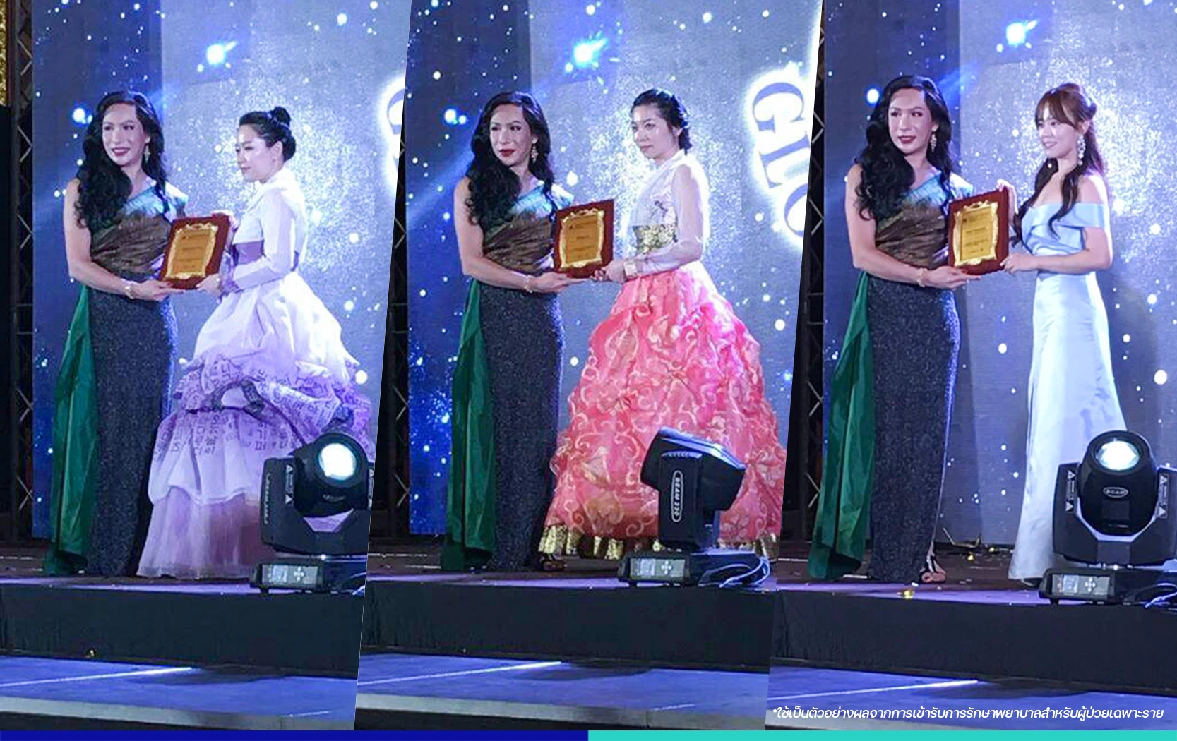 รีวิวรักษาฝ้ากระ มั่นใจมากขึ้น