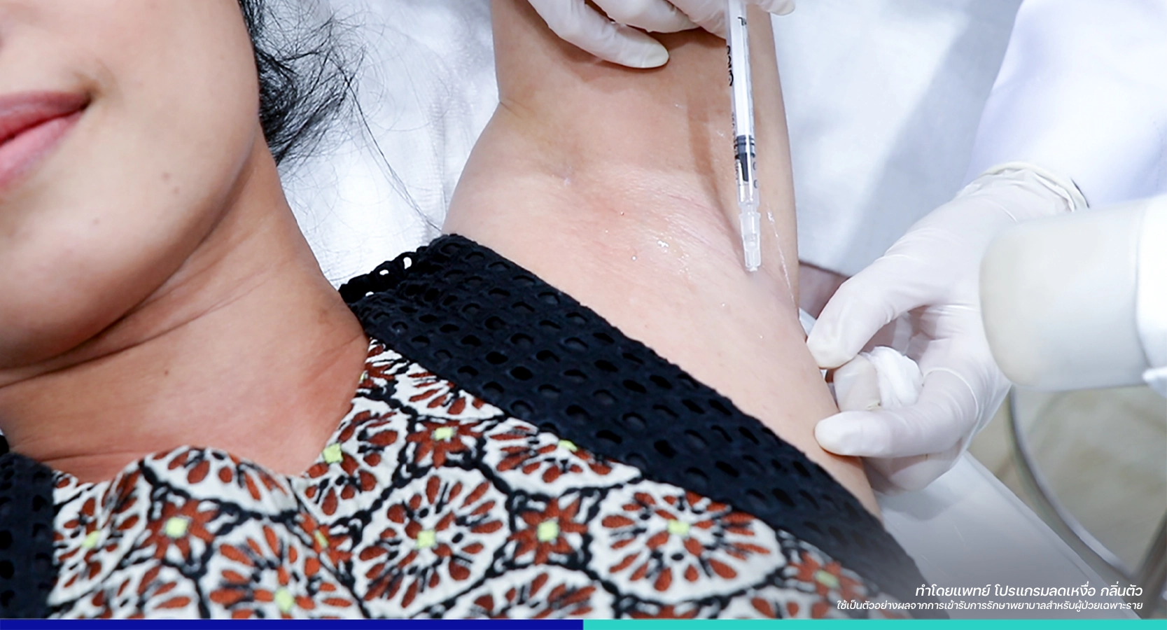 รีวิวลดเหงื่อรักแร้