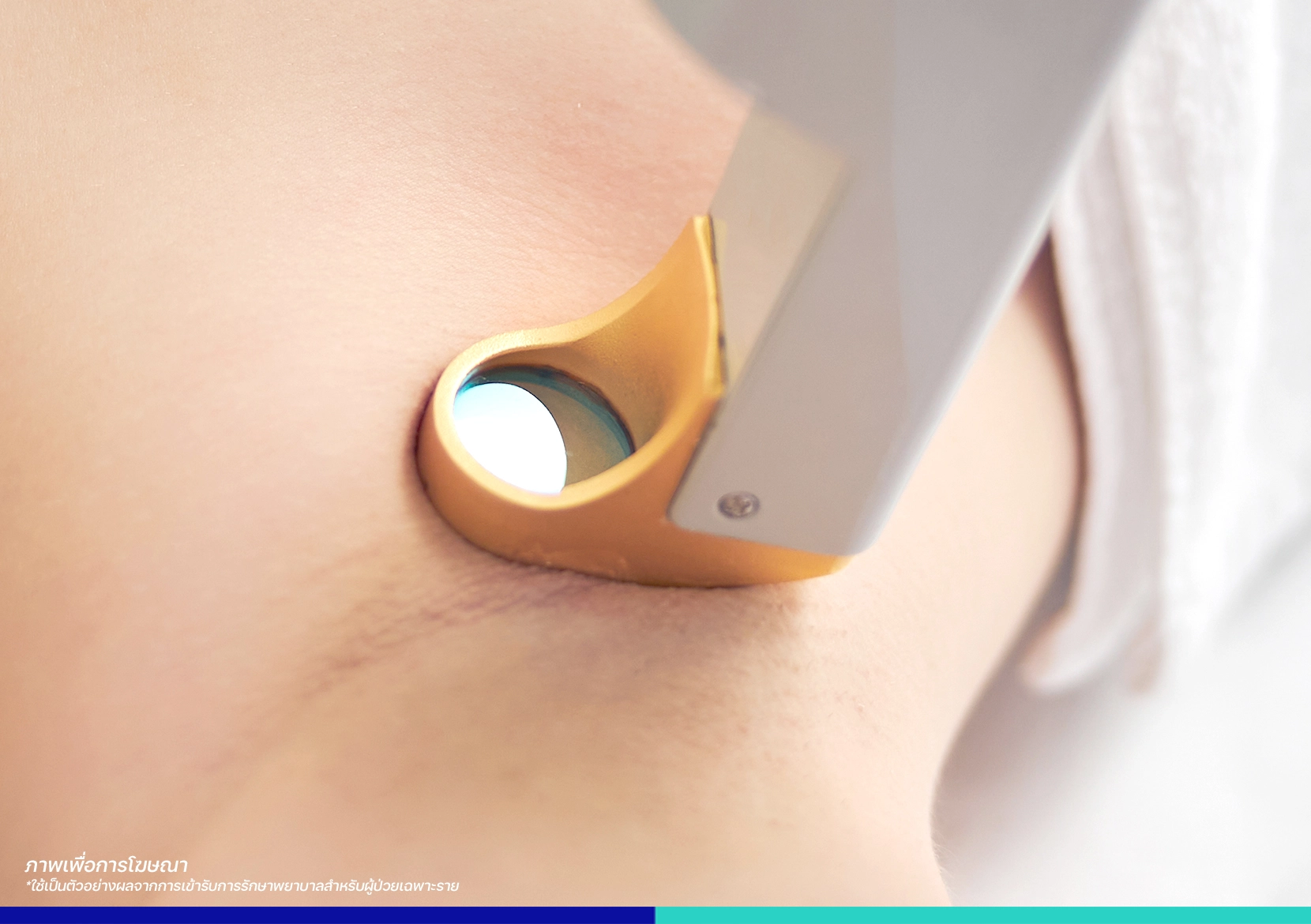 แก้รักแร้ดำ