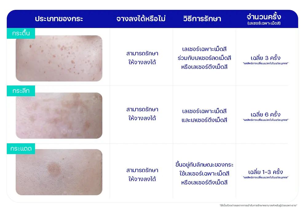 รีวิวรักษากระลึก