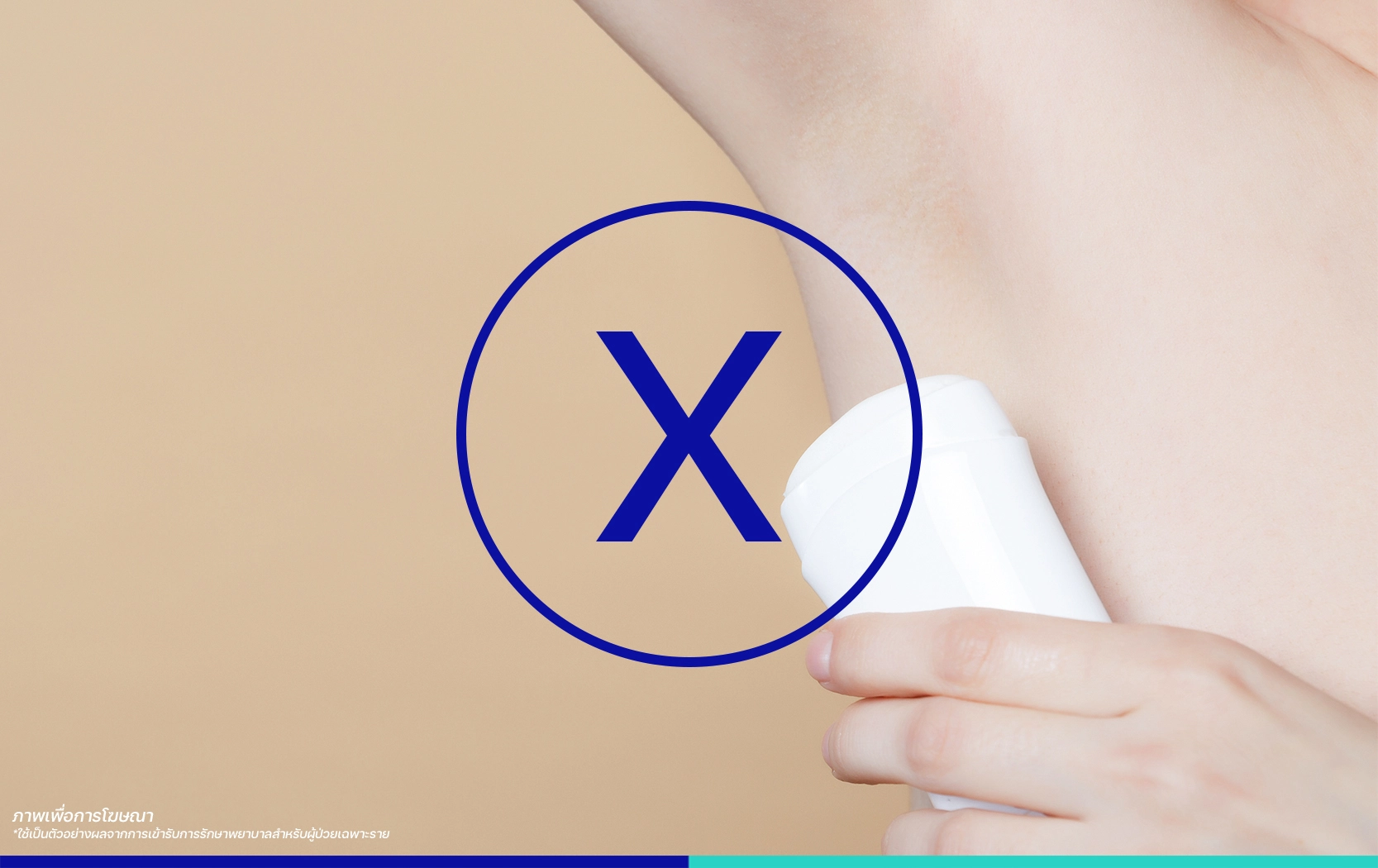 เลเซอร์กำจัดขนรักแร้