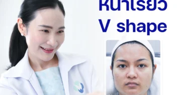 ปรับรูปหน้า