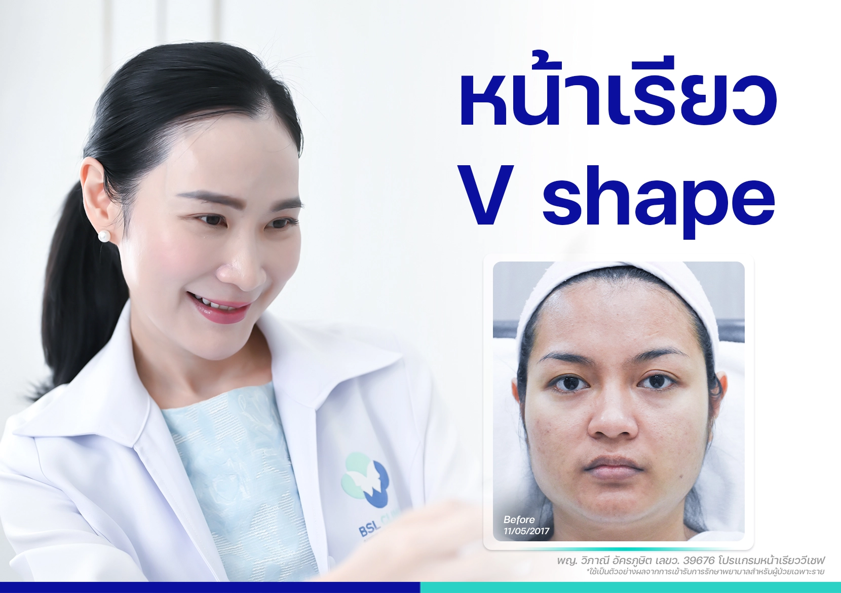 หน้าเรียว