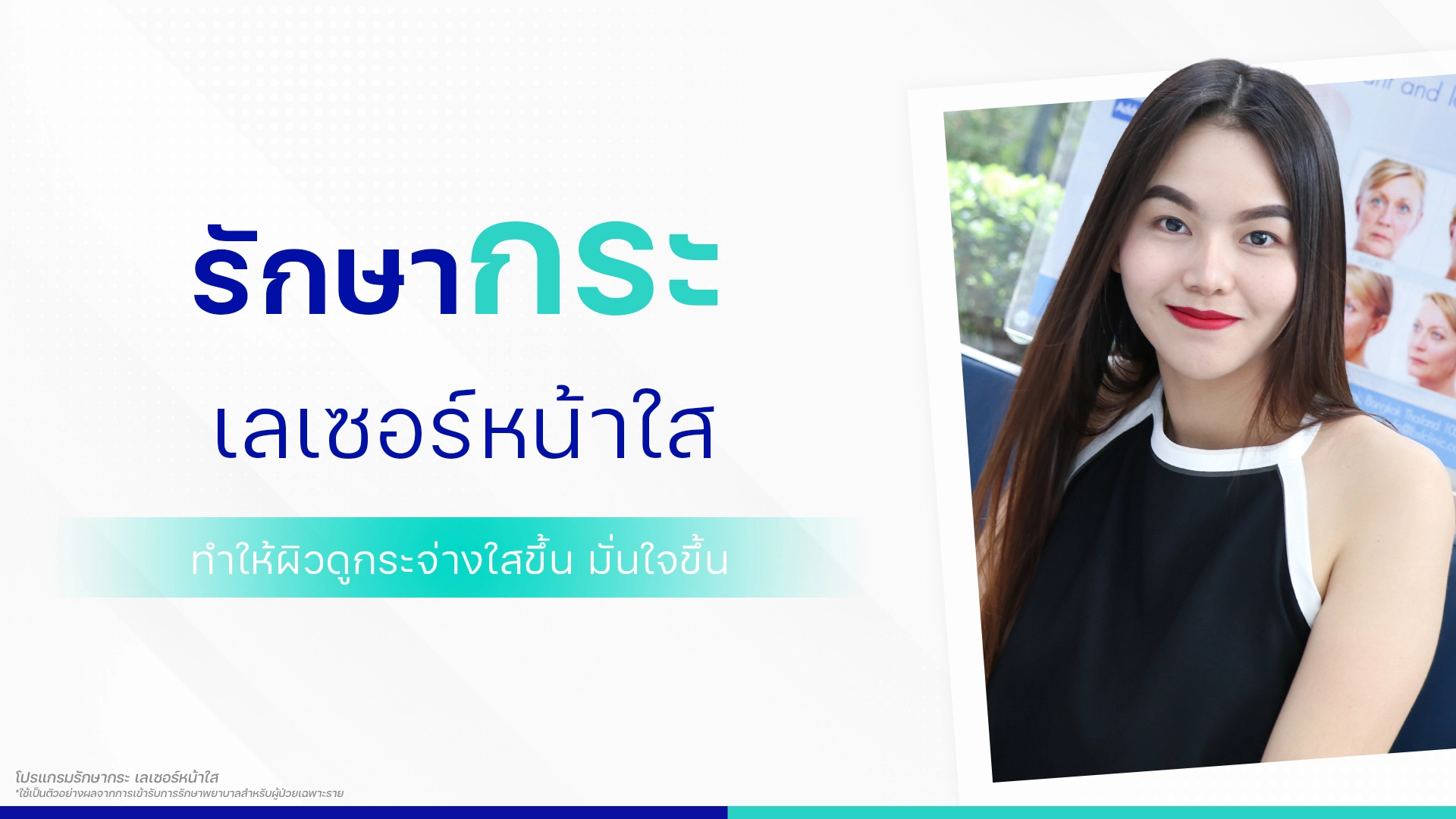 รีวิวเลเซอร์หน้าใส