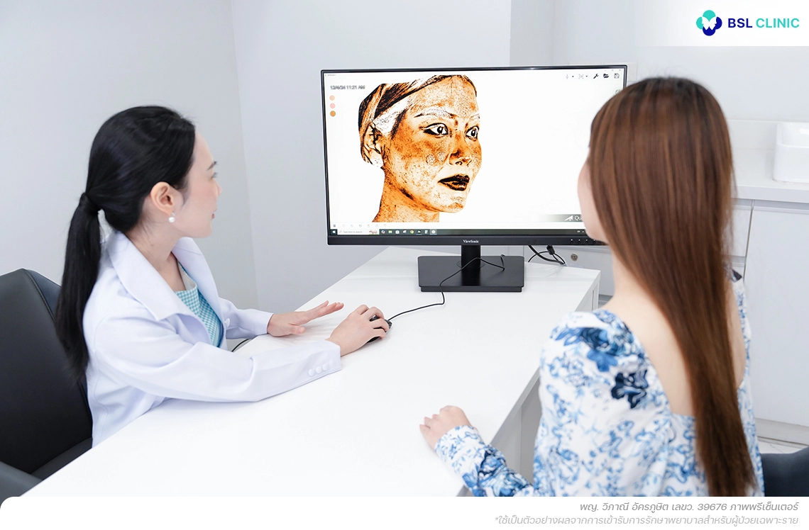 ความซับซ้อนของกลไกการเกิดฝ้าและการวินิจฉัย