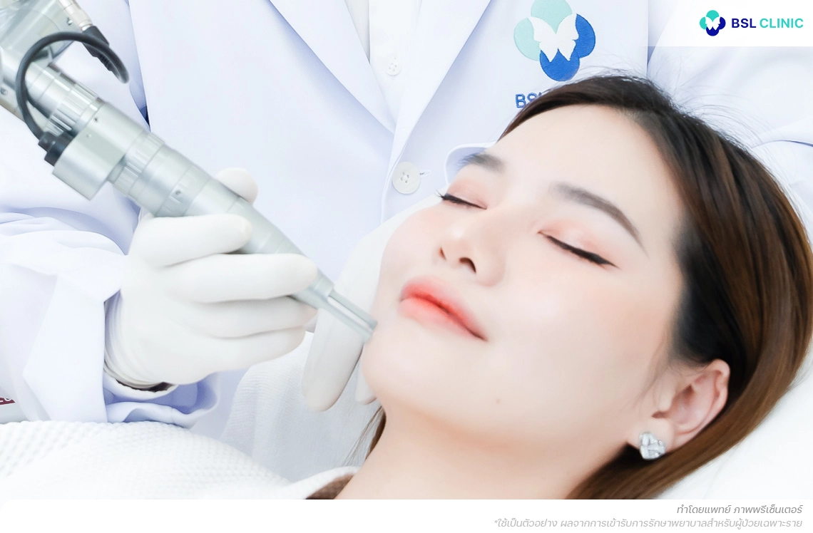 ความรู้เชิงลึกในการใช้เทคโนโลยีเลเซอร์และทรีตเมนต์ของแพทย์