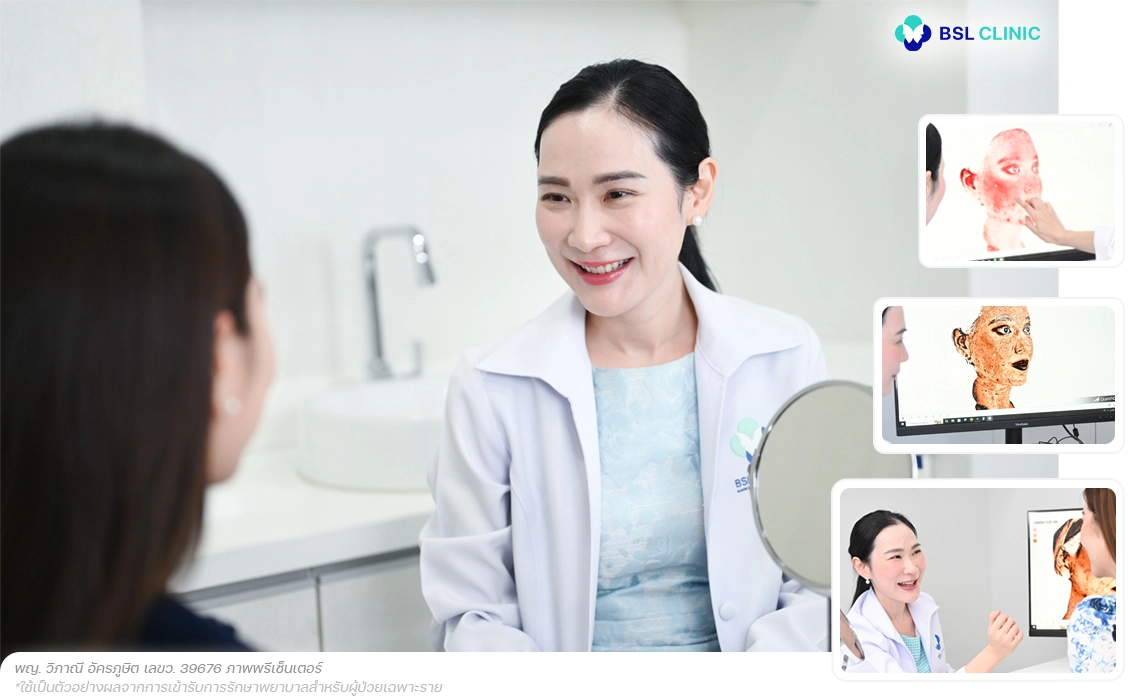 การรักษาฝ้าฮอร์โมน อยู่ภายใต้การดูแลของแพทย์ที่เข้าใจฝ้า