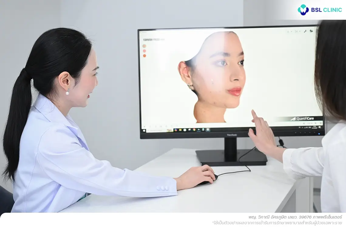 วิธีรักษาสิวอักเสบ