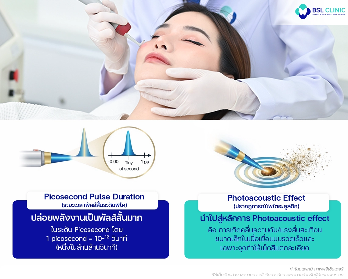 Pico Laser พิโค่เลเซอร์โปรแกรม คืออะไร ?