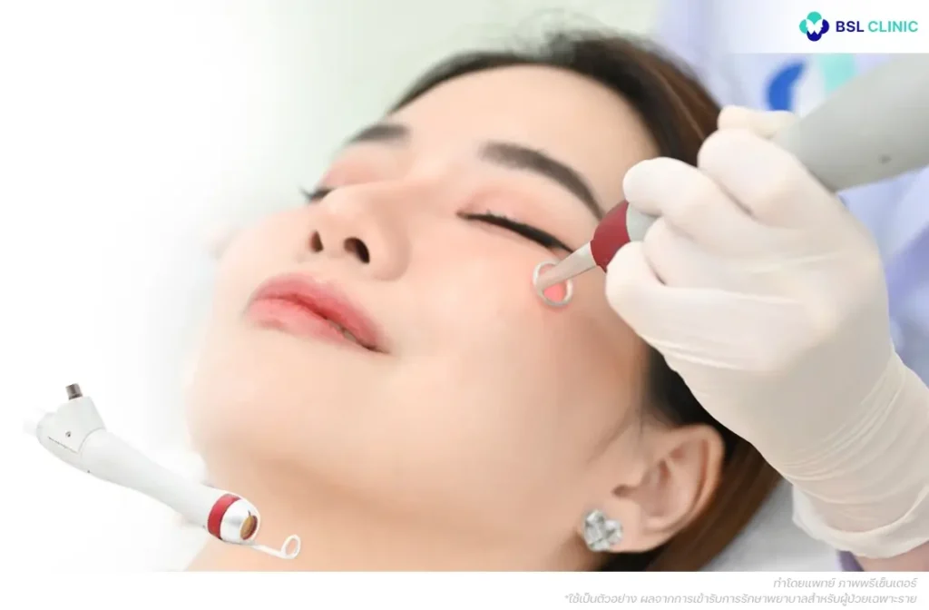 PicoWay 532nm(Standard) Program