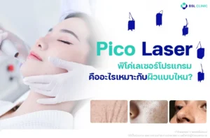Pico Laser คืออะไร เหมาะกับใคร