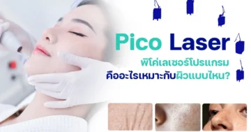 Pico Laser คืออะไร เหมาะกับใคร