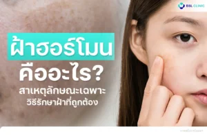 ฝ้าฮอร์โมนเกิดจากอะไร