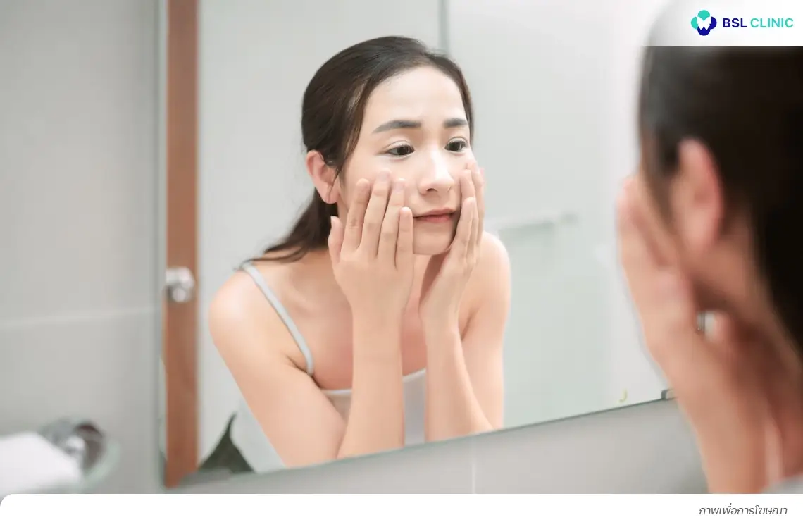 กลไกการเกิดฝ้าฮอร์โมน