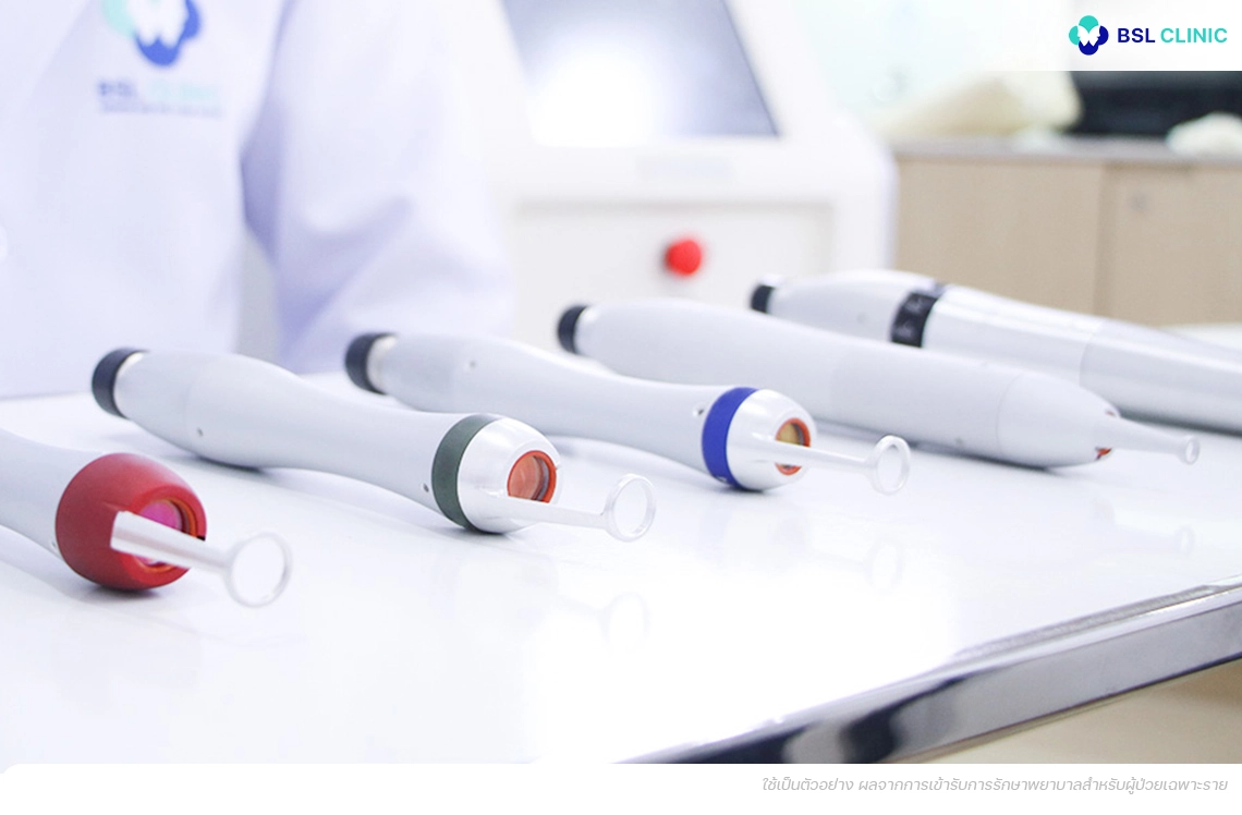 หัวพิโค่เลเซอร์โปรแกรม