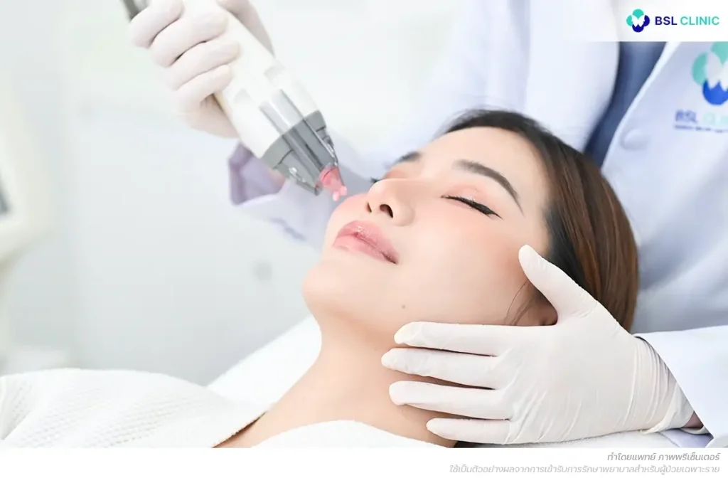 รูขุมขนอุดตัน