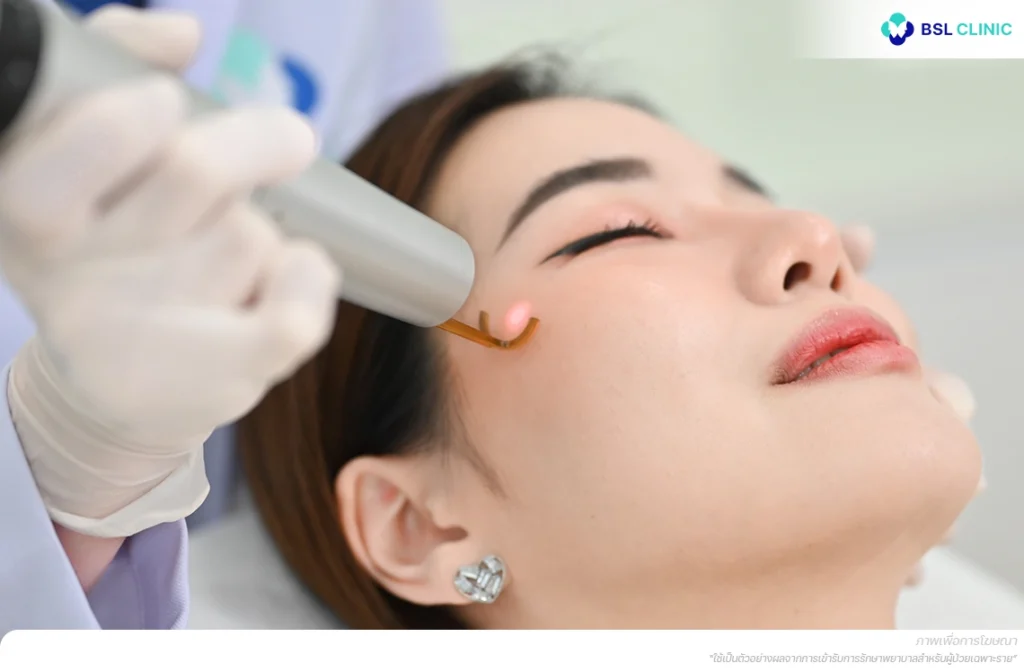 ลดความเสี่ยงรอยดำหลังรักษา