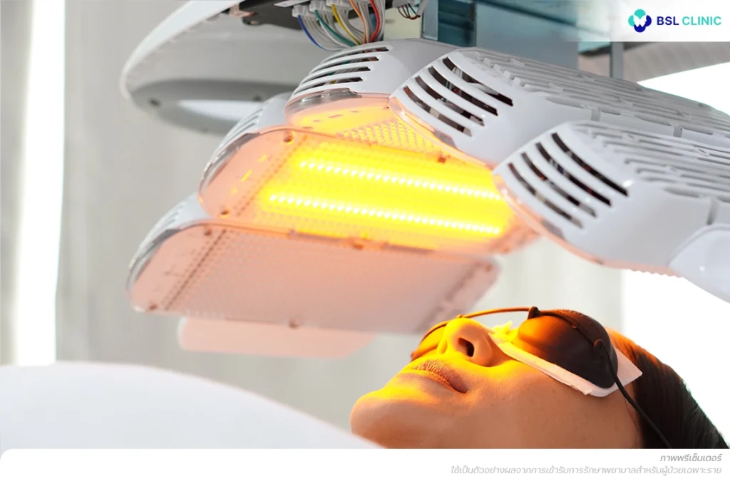 โปรแกรมฉายแสง