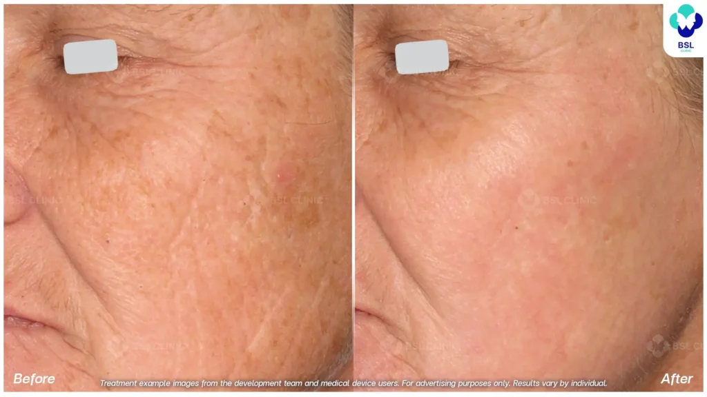 Before-and-After-1