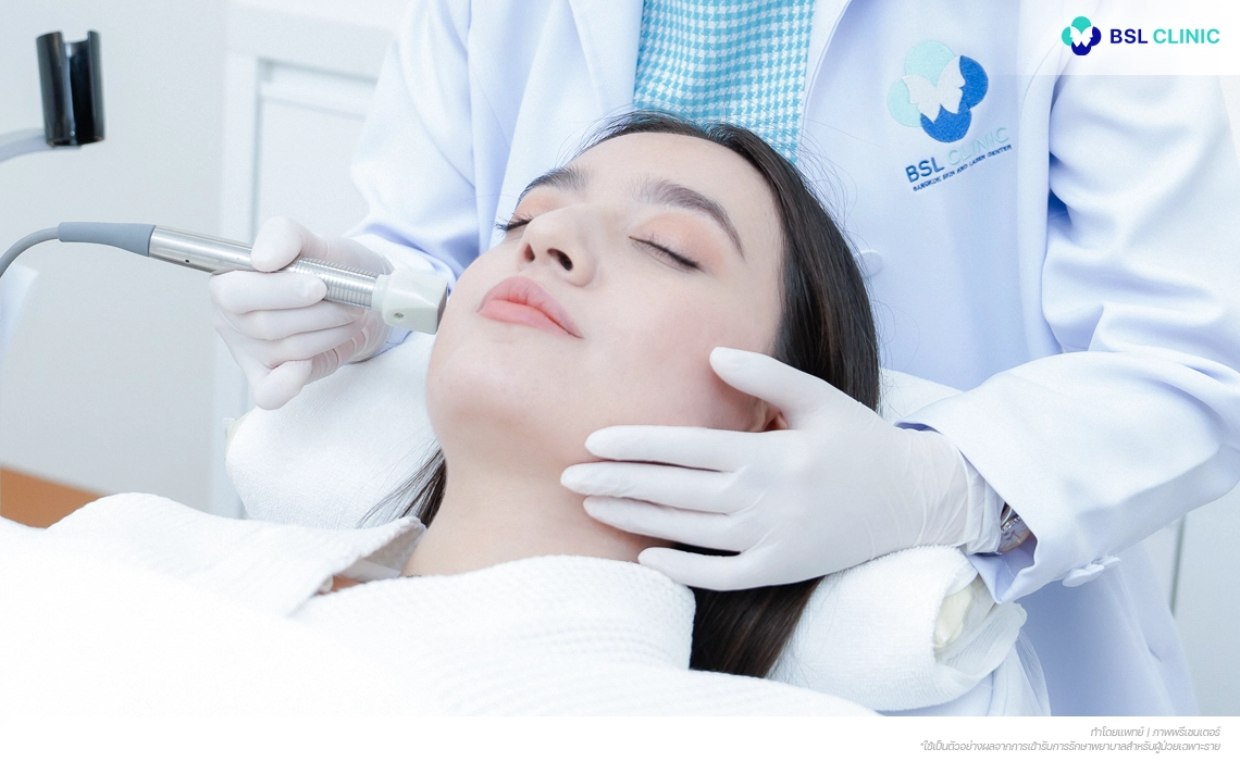 Fractora-Program-เลเซอร์หลุมสิวที่ลึกปานกลาง-ให้หลุมสิวตื้นขึ้น