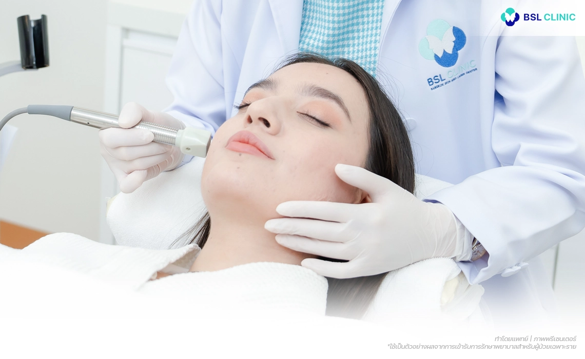 Fractora-Program-เลเซอร์หลุมสิวที่ลึกปานกลาง-ให้หลุมสิวตื้นขึ้น