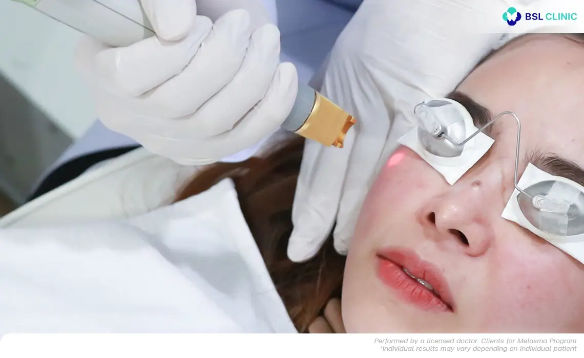 Redness: Visible Capillaries