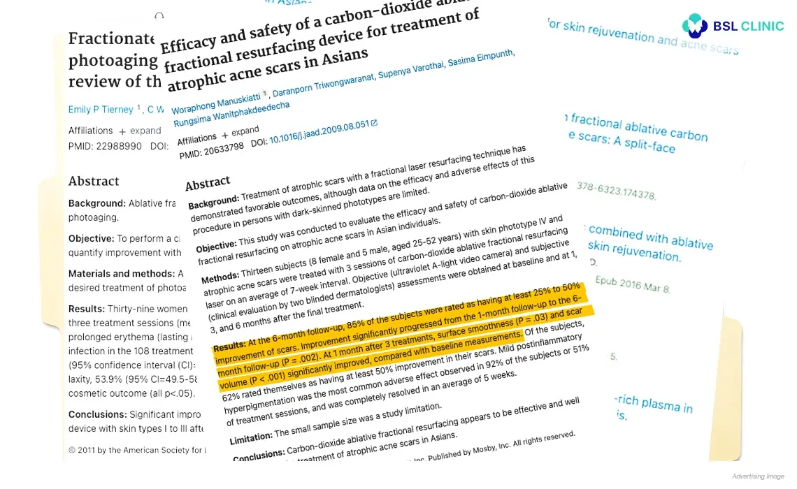 What Research Shows About Fractional CO2 Laser Program