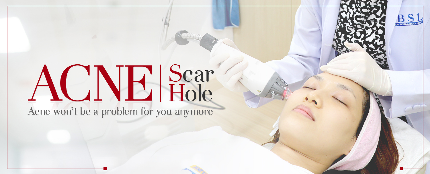 Acne Scarring and Blemish Treatment