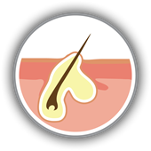 Acne Scarring