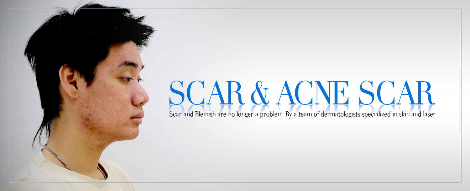 Scarring and Blemish Removal