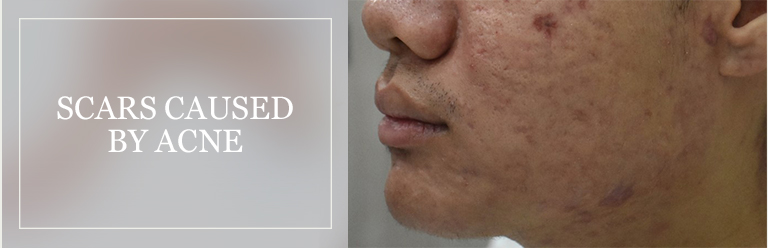 Treatable Surgical and Scarring