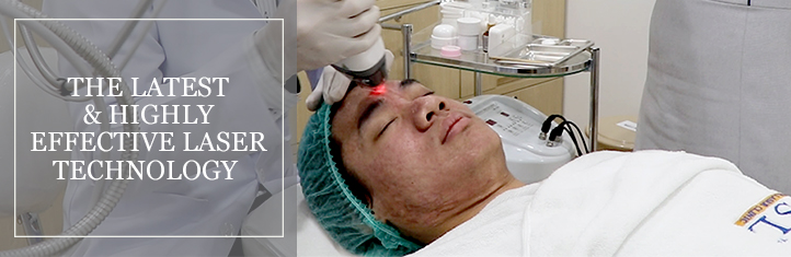 Potential Effects of Laser Treatment for Pitted Scarring