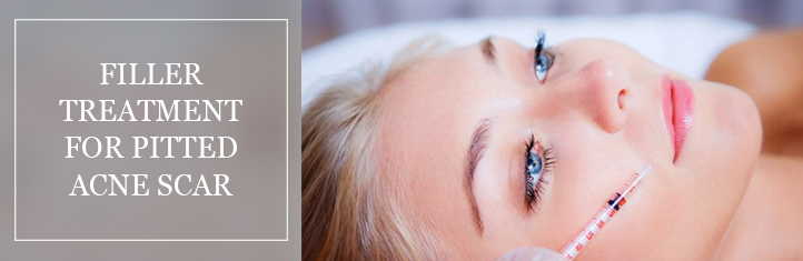 Scarring Filler Treatment