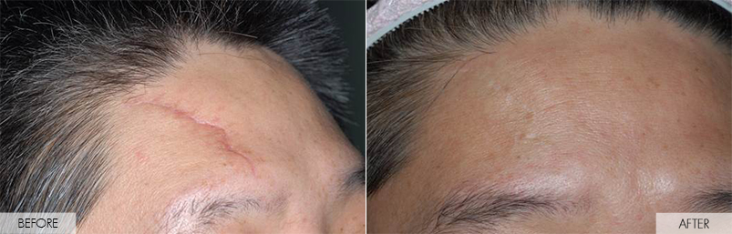 before and after treatment
