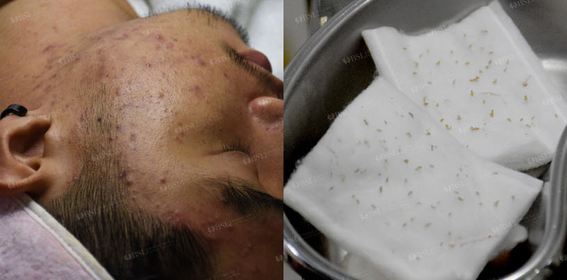Before and After Treatment